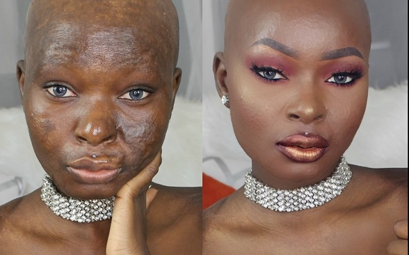 black beauty influencer Shalom Blac